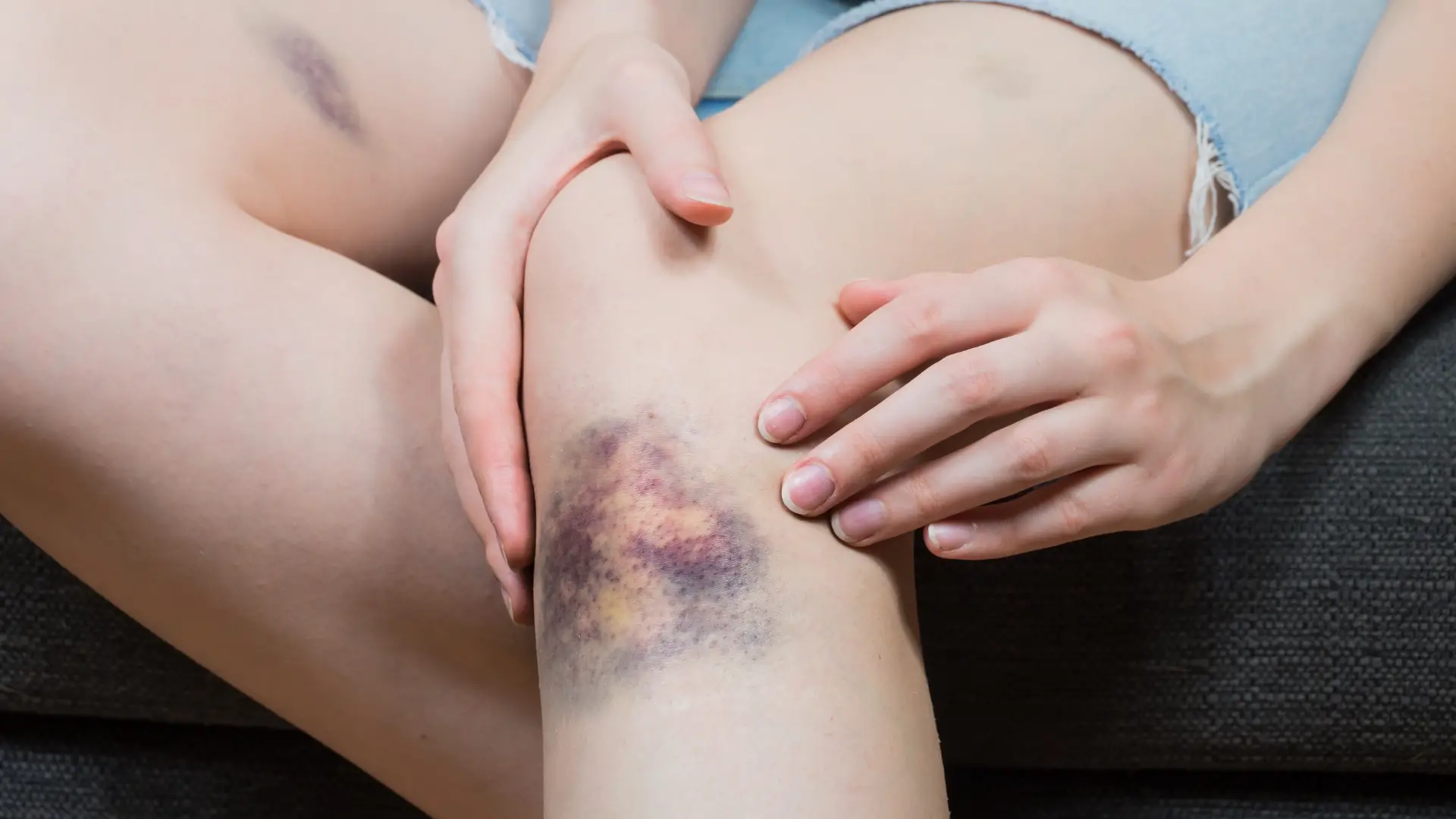 Các loại chấn thương phổ biến trong thể thao và tại sao Bình xịt lạnh giảm đau Ligpro là lựa chọn ưu tiên hàng đầu?