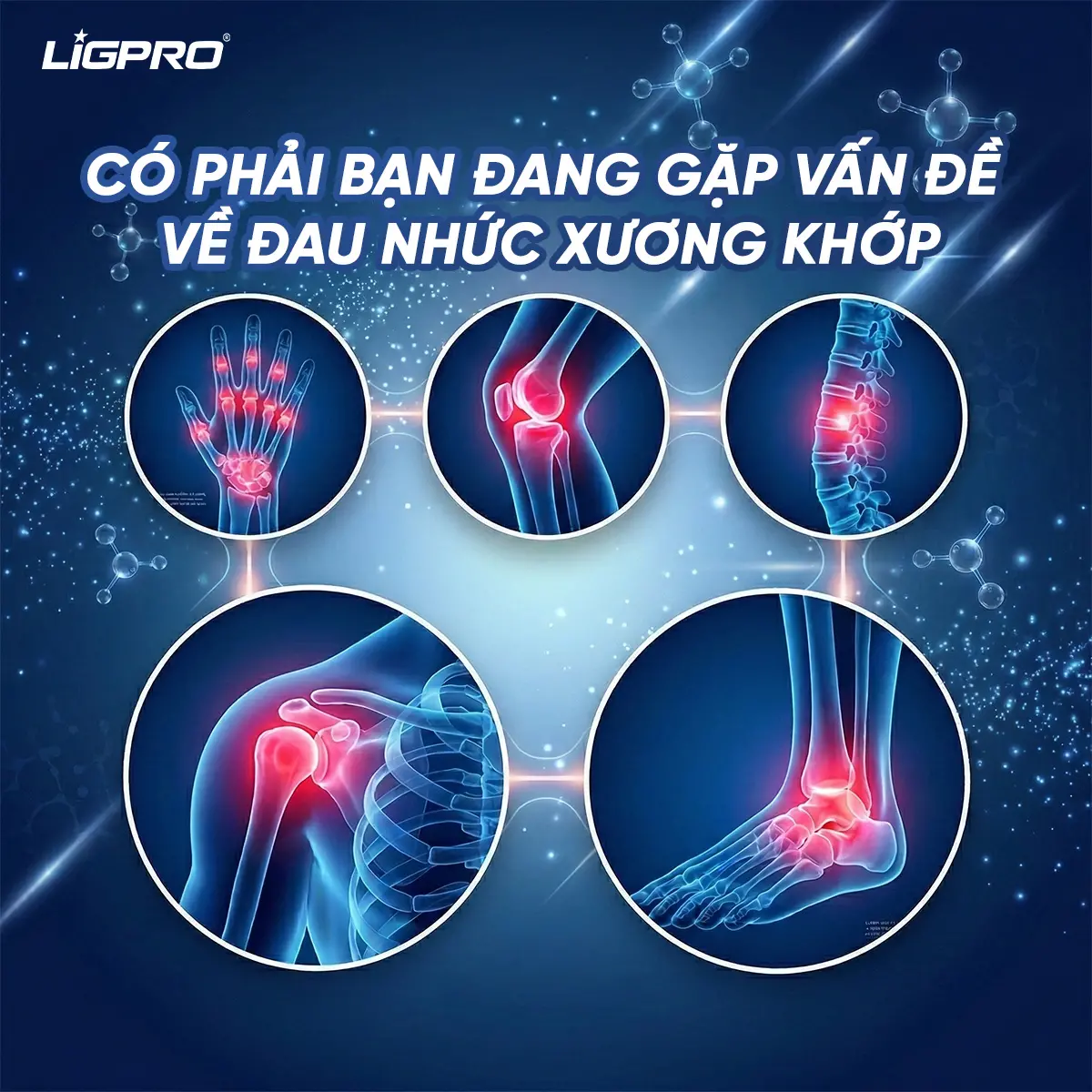 Combo Gel Xoa Bóp Dành Cho Xương Khớp Ligpro – Giải Pháp Toàn Diện Cho Cơ Khớp
